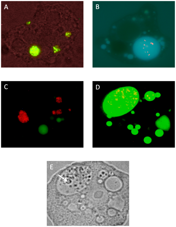Viable and heat killed C. jejuni are taken up into different types of A. polyphaga vacuoles. (A) Live/Dead stained viable (green) C. jejuni, confined to tight vacuoles. (B) Live/Dead stained heat killed (red) C. jejuni residing in giant spacious vacuoles. (C) Vaculoes with CTC stained viable (red) C. jejuni do not co-localize with Alexa fluor-488 labeled dextran filled vacuoles (green). (D) Vaculoes with CTC stained heat killed (red) C. jejuni have taken up Alexa fluor-488 labeled dextran (green). (E) In contrast to non digestive vacuoles, giant digestive vacuoles contained smaller vesicles (arrow). Picture D and E are from the same amoeba. doi:10.1371/journal.pone.0078873.g004