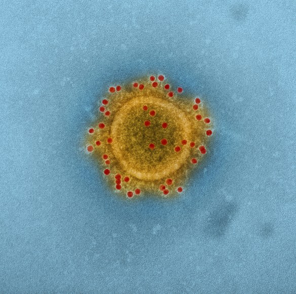 A Middle East Respiratory Syndrome Coronavirus - better known as MERS-CoV. This novel zoonotic pathogen is of great concern in the Middle East. Avian CoVs are not linked to disease in humans.